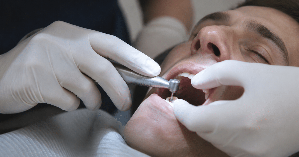 Dentiste limant une dent cassée avec instrument rotatif