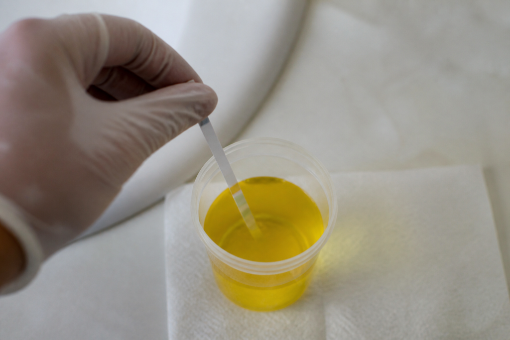 Bandelette trempe dans echantillon d'urine jaune