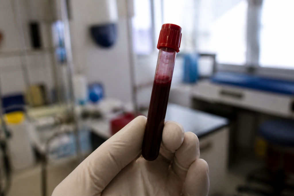 tube de sang rouge pret pour analyse