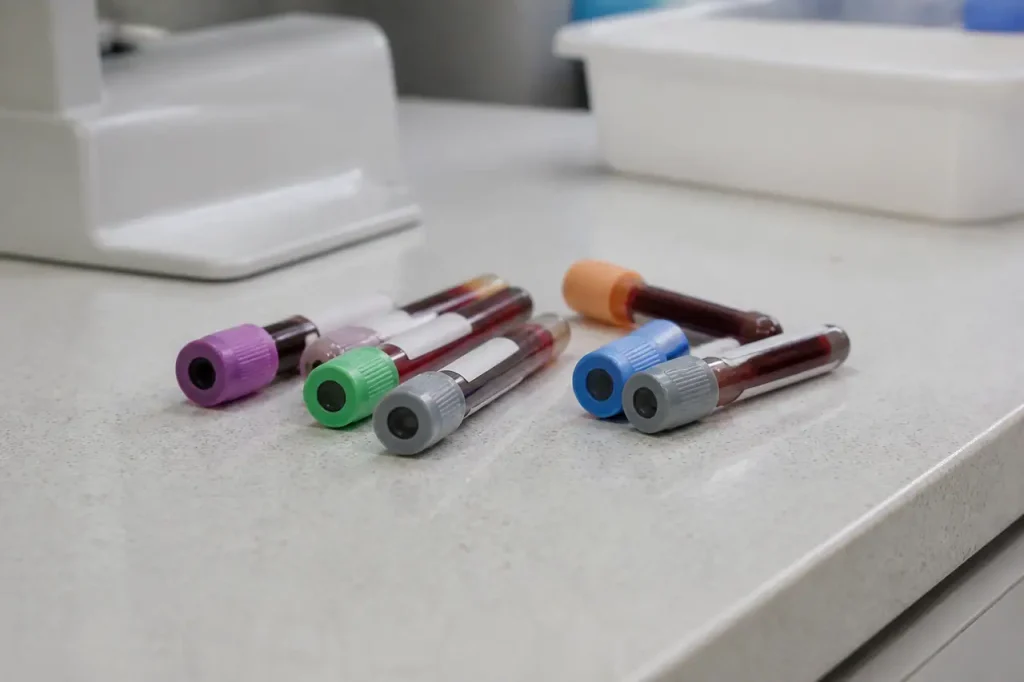 Tubes de prelevement sanguin etiquetes sur paillasse blanche